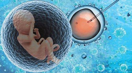 体外受精 IVF-ET